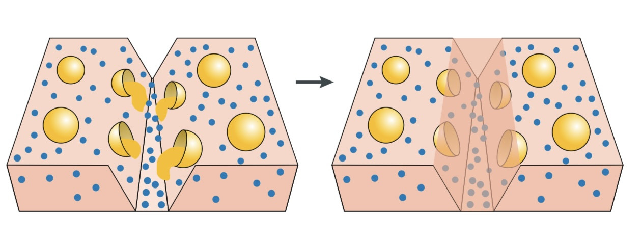 pyshrftha-dr-plymrhay-khodtrmymshondh-sazokarha-karbrdha-o-chshmandaz-ayndh-image